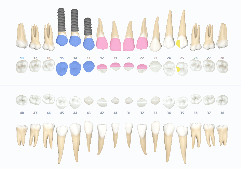 ProDental dental chart